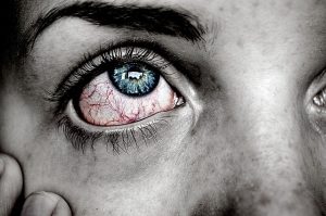 Gerötete, juckende Augen sind häufig ein Allergie-Symptom